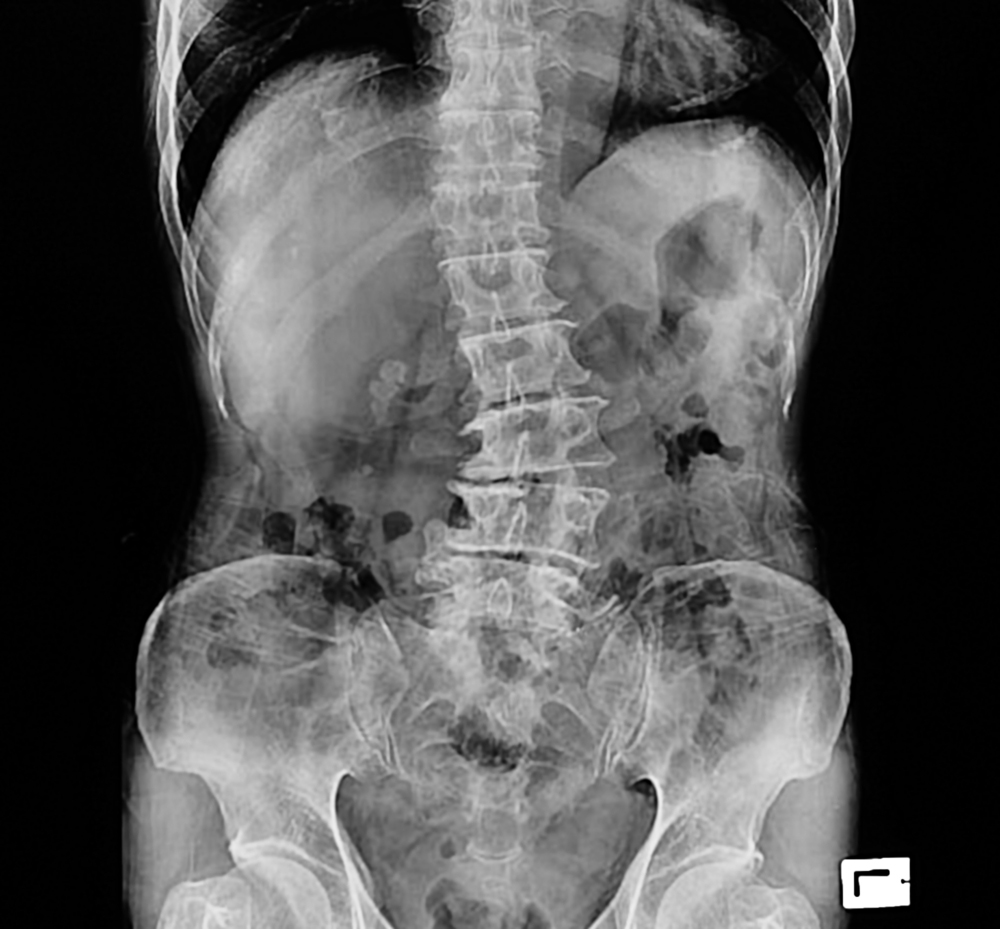 Chiropractic examination